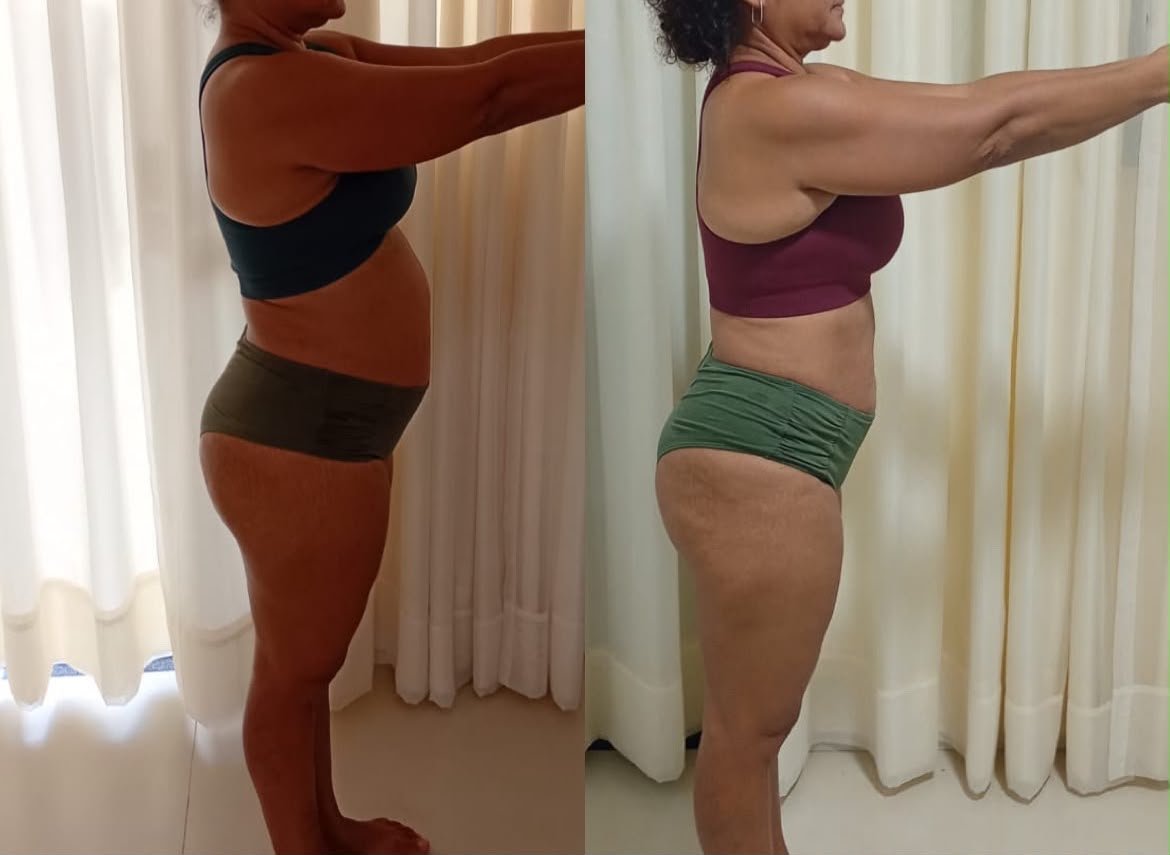 Resultado real de aluna 1 — antes e depois